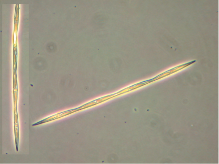 microscopic photo of two pseudo-nitzschia cells