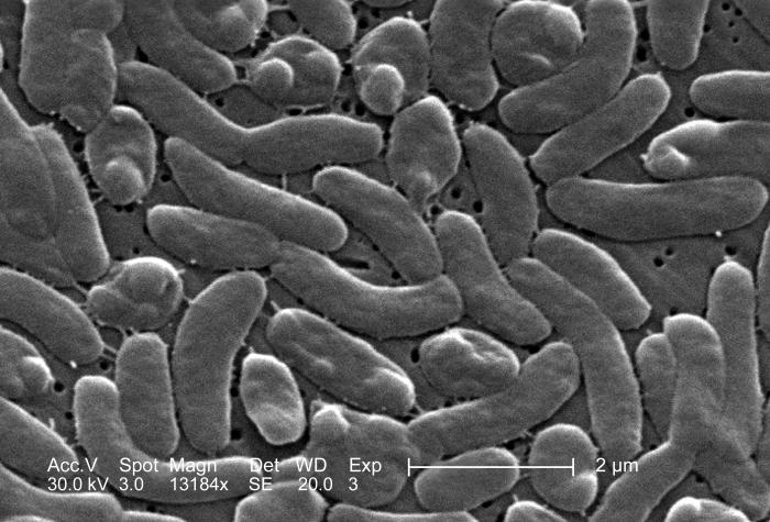 Microscopic image depicting a grouping of Vibrio vulnificus bacteria.
